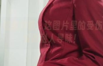 丽柜 – 观看钟情：这图片里的受伤玉足竟如此耐人寻味！